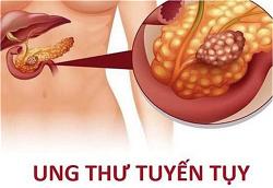ung-thu-tuyen-tuy