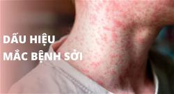 benh-soi